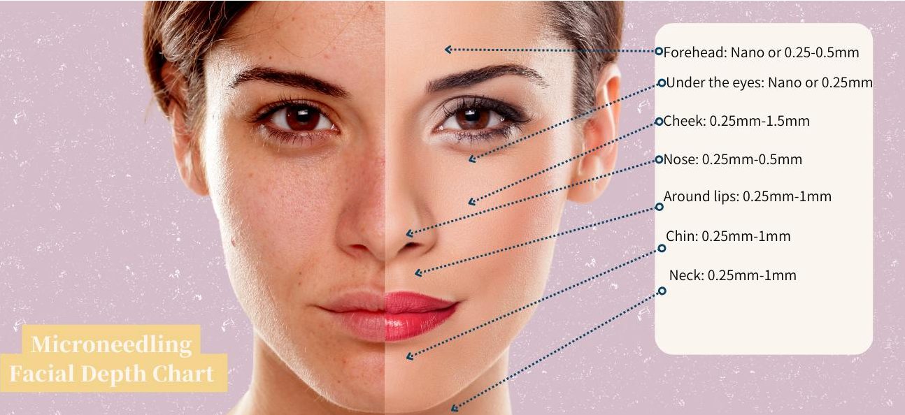 how to choose needle length of derma pen