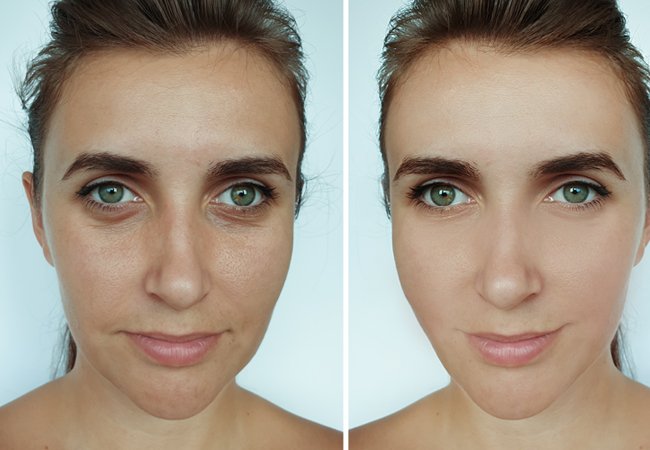 twist_lifting_before_and_after