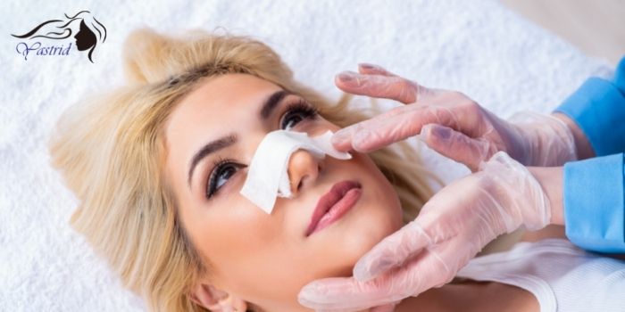 How Much Does a Nose Thread Lift Cost for lady
