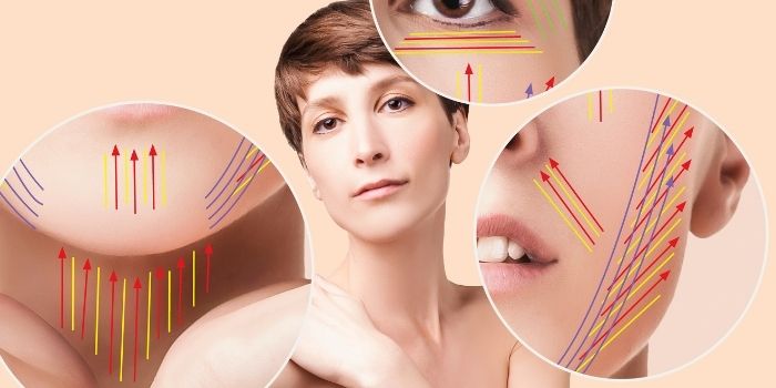 Neck Thread Lift