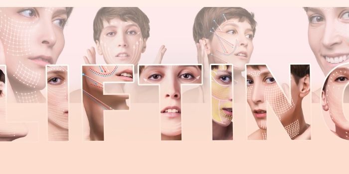 Neck lift with Thread