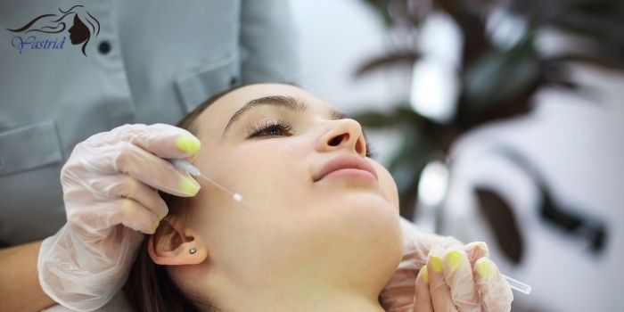 Non-surgical Facelift with PDO Threads