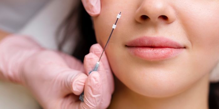 How Painful is a PDO Thread Lift
