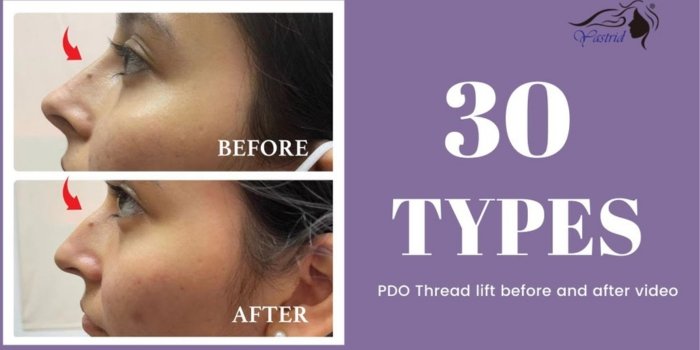 PDO Threads From Customers to Brand Ambassadors