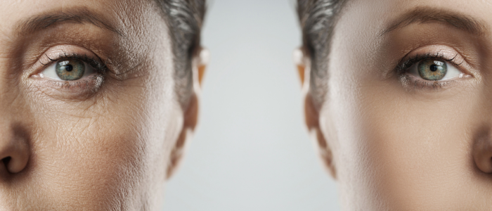 how to use hyaluronic acid