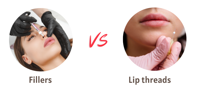 lip threads vs. fillers