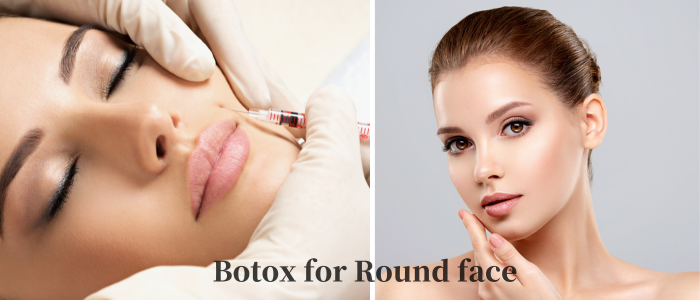 Botox for round face