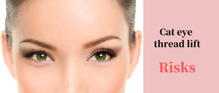 Cat eye thread lift