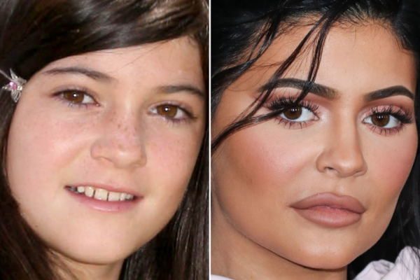 The Secret Behind Kylie Jenner's lips