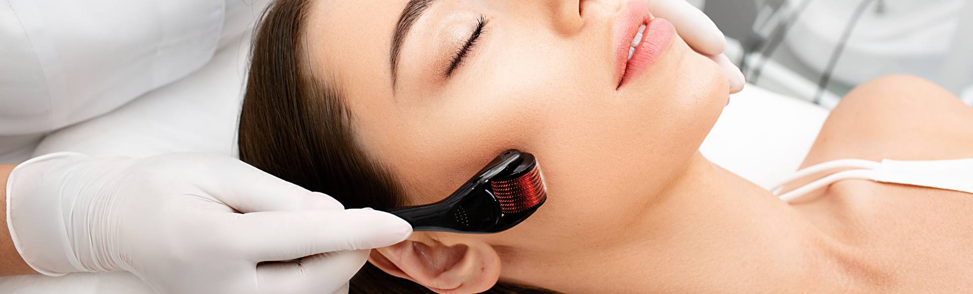 Yastrid derma roller