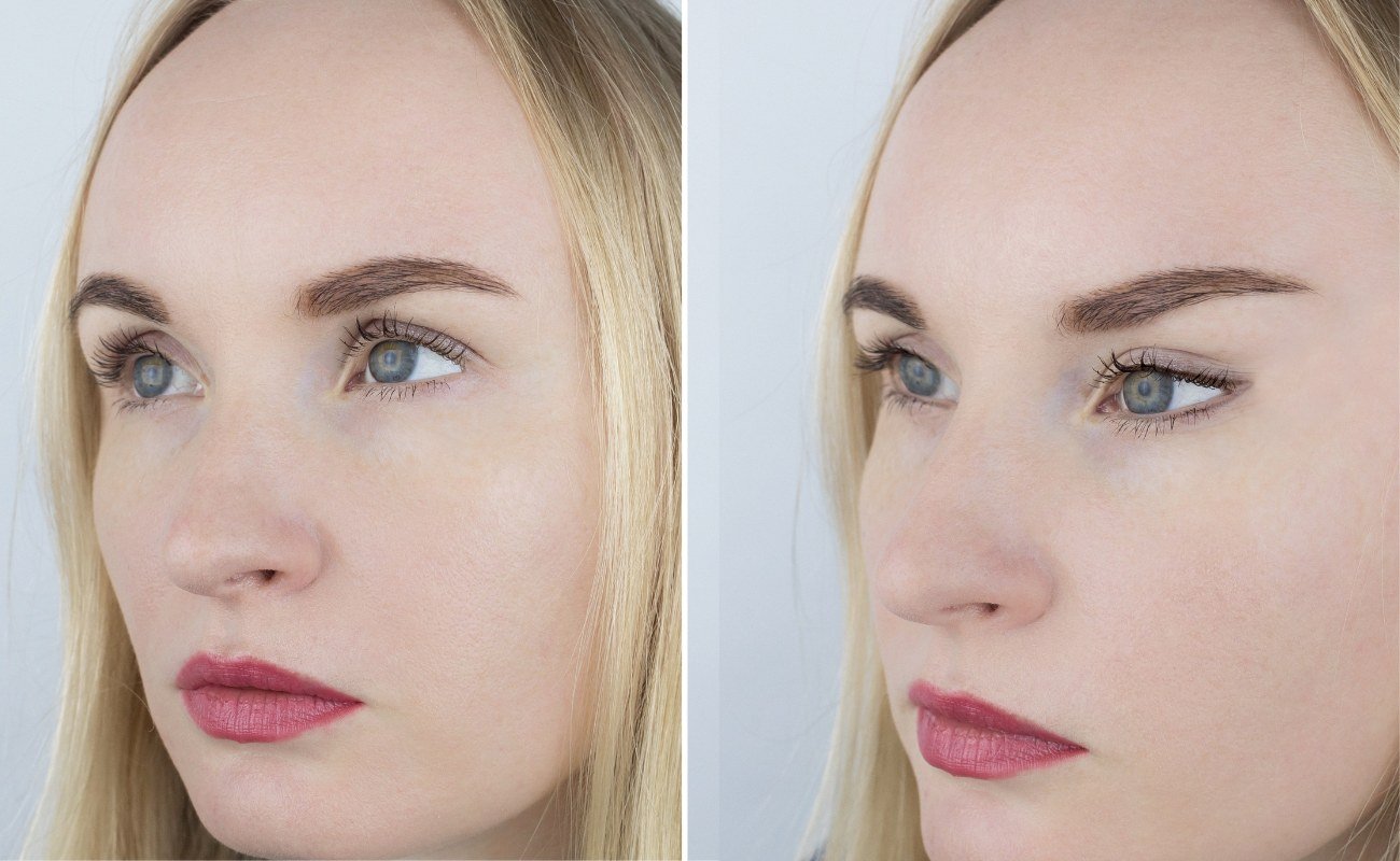 PDO cog thread lift for brows before and after