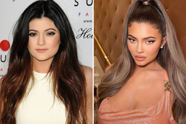 The Secret Behind Kylie Jenner's lips