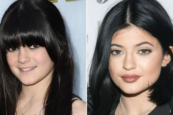 The Secret Behind Kylie Jenner's lips