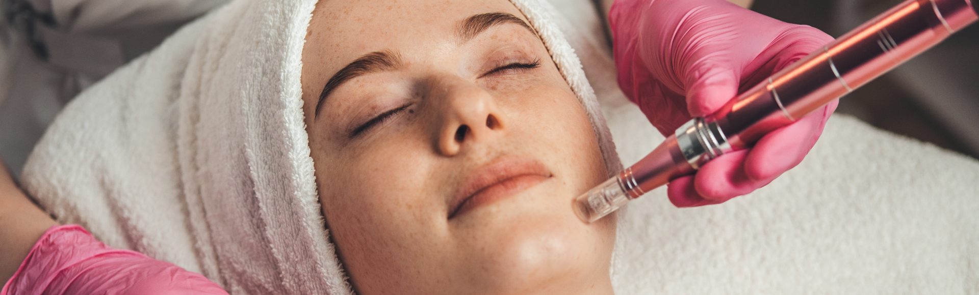 derma pen for face