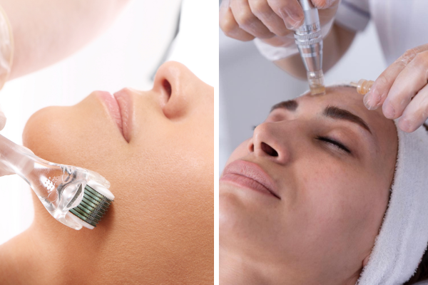 Derma Roller vs Derma Pen