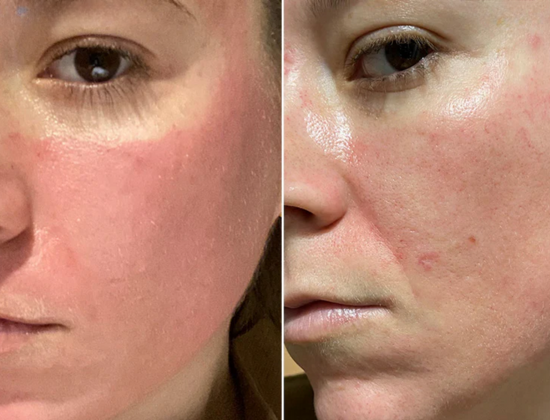 Yastrid Repair Fask Mask benefits
