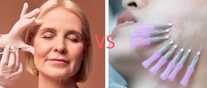 PDO threads VS bOTOX