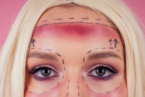 the outcome of Making Your Own Collagen Threads at Home