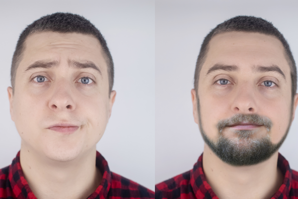 after using the derma roller for beard growth