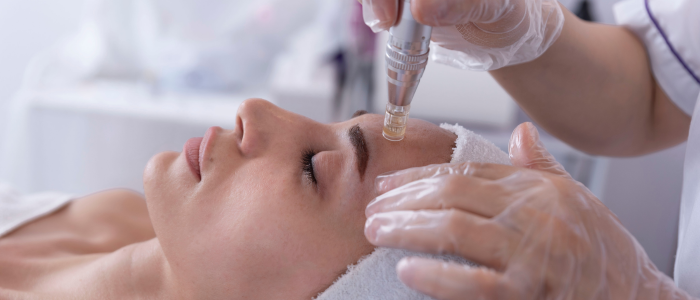 micro needling stamp