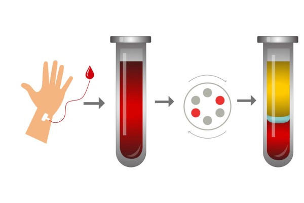 PRP principle