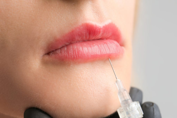 What to Expect The First Day After Lip Injections