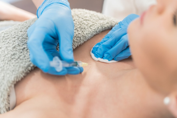 PDO Thread Breast Lift