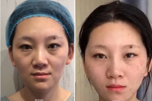 before & after 1